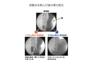 炭酸水がダイエット中にもたらす効果がすごい！その効果と正しい選び方